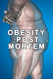 Obesity: The Post Mortem Obesity: The Post Mortem